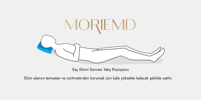 Saç Ekimi FUE - Lateral Slit Tekniği